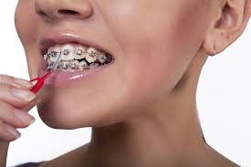 ortodontie-02